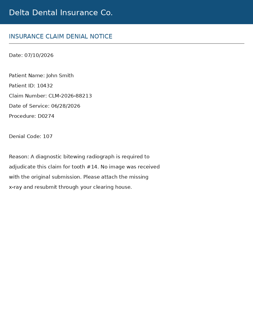 Sample denial letter asking for a radiograph of tooth 14. Watermarked as demo data for a fictional patient.